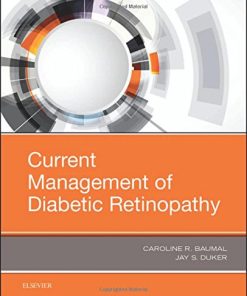 Current Management of Diabetic Retinopathy, 1e (PDF)