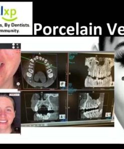 DentalXP Porcelain Veneers (Course)