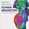 MRI/DTI Atlas of the Human Brainstem in Transverse and Sagittal Planes (EPUB)