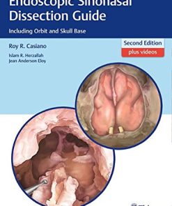 Endoscopic Sinonasal Dissection Guide: Including Orbit and Skull Base, 2nd Edition (PDF)