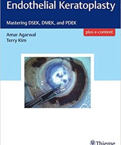 Endothelial Keratoplasty: Mastering DSEK, DMEK, and PDEK (PDF)