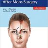 Facial Reconstruction After Mohs Surgery (EPUB)