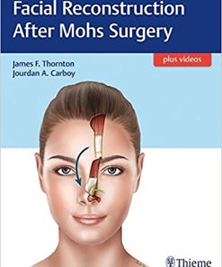 Facial Reconstruction After Mohs Surgery (EPUB)