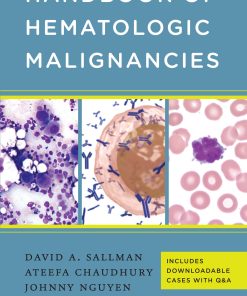 Handbook of Hematologic Malignancies (EPUB)