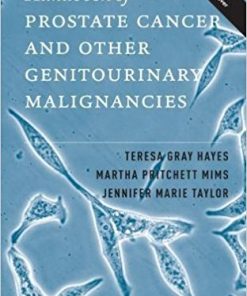 Handbook of Prostate Cancer and Other Genitourinary Malignancies (PDF)