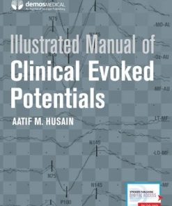 Illustrated Manual of Clinical Evoked Potentials (EPUB)