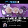 LearnyLib Restaurations Directes Postérieures – Hugues de Belenet Analyse, Preperetion, et Stratirifacation des Composites Directs (Francais) (Course)