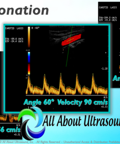 Mastering Doppler Principles and Hemodynamics- AllAboutUltrasound (HTML)