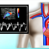 Mastering Upper Extremity Duplex – AllAboutUltrasound (HTML)