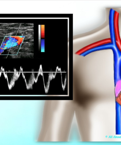 Mastering Upper Extremity Duplex – AllAboutUltrasound (HTML)