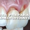 Mastery Academy Veneer Preparation and Administration – Anas Aloum (Course)