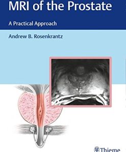 MRI of the Prostate: A Practical Approach (PDF)