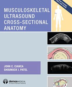 Musculoskeletal Ultrasound Cross-Sectional Anatomy (PDF)