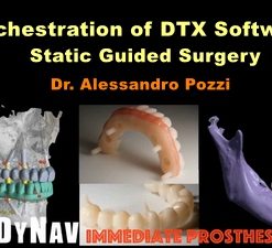 Orchestration of DTX Software Static Guided-Surgery (Course)