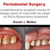 Periodontal Surgery: A Comprehensive Surgical Course (Course)