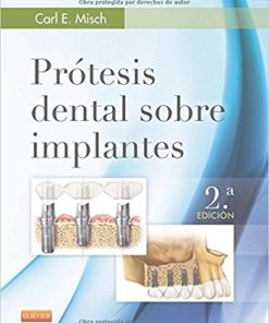 Prótesis dental sobre implantes (Spanish Edition), 2e (PDF)