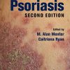 Psoriasis, Second Edition (PDF)