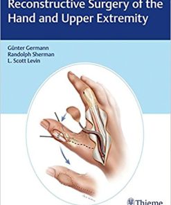 Reconstructive Surgery of the Hand and Upper Extremity (PDF)