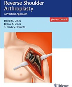 Reverse Shoulder Arthroplasty: A Practical Approach (EPUB)