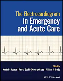 The Electrocardiogram in Emergency and Acute Care (PDF) The Electrocardiogram in Emergency and Acute Care (PDF)