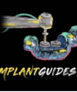 Implant Ninja .The Implant Guides 101 Course (Course)