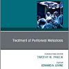 Treatment of Peritoneal Metastasis, An Issue of Surgical Oncology Clinics of North America (Volume 27-3) (The Clinics: Surgery, Volume 27-3) (PDF)