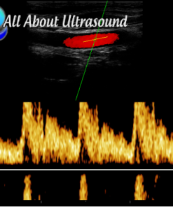 Ultrasound Physics SPI – Registry Review Course – AllAboutUltrasound (HTML)