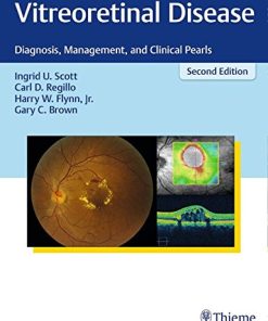 Vitreoretinal Disease: Diagnosis, Management, and Clinical Pearls, 2nd Edition (EPUB)