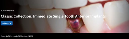 Classic Collection: Immediate Single Tooth Anterior Implants