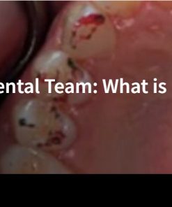 Part 1: Occlusion for the Dental Team: What is it and Why Do We Care