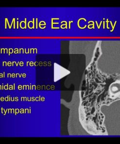 Temporal Bone Imaging Made “Easy”: Basic to Advanced Online Course