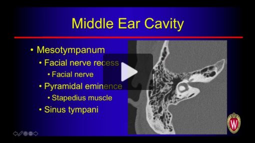 Temporal Bone Imaging Made “Easy”: Basic to Advanced Online Course