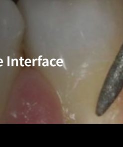 The Periodontal-Restorative Interface