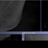 What Is Cone Beam CT