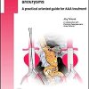 Medical treatment and operative repair of abdominal aortic aneurysms (UNI-MED Science) (PDF)