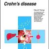 Ulcerative colitis – Crohn’s disease (UNI-MED Science) (PDF)