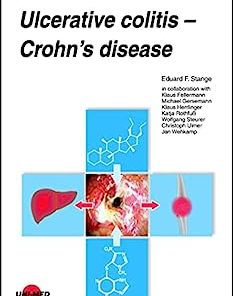 Ulcerative colitis – Crohn’s disease (UNI-MED Science) (PDF)
