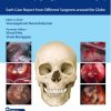 100 Complications of Otorhinolaryngology & Skull Base Surgery (PDF Book+Videos)