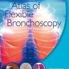 Atlas of Flexible Bronchoscopy 1st Edition (PDF)