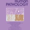 Human Pathology PDF