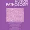 Human Pathology PDF