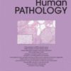 Human Pathology PDF