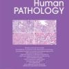 Human Pathology PDF