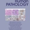 Human Pathology PDF