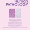 Human Pathology PDF