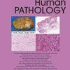 Human Pathology Volume 142