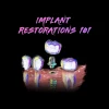 Implant Restorations 101 (Course)