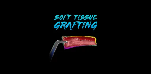 Ninja Soft Tissue Grafting (Course)