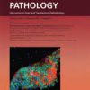 The American Journal of Pathology PDF