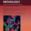 The American Journal of Pathology PDF